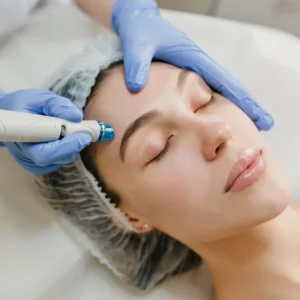Bioestimuladores de Colágeno + 2 sesiones de Radiofrecuencia