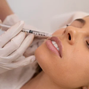 Relleno de Labios (1 ml)